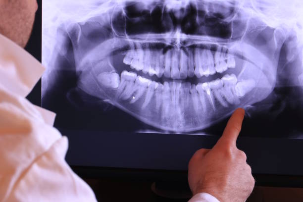 Best Cracked Tooth Emergency Dentist  in Lakeview, WA